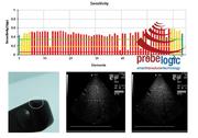 Acuson/Siemens V5Ms Cardiac Phased array probe image degradation