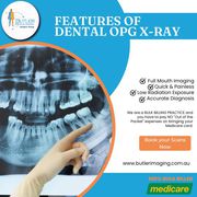 Features of Dental OPG X-Ray at Butler Medical Imaging.(08) 9544 3999