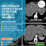 Multiphase Liver CT Scan at Butler Medical Imaging. (08) 9544 3999 