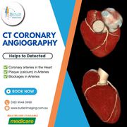 CT Coronary Angiography at Butler Medical Imaging! (08) 9544 3999